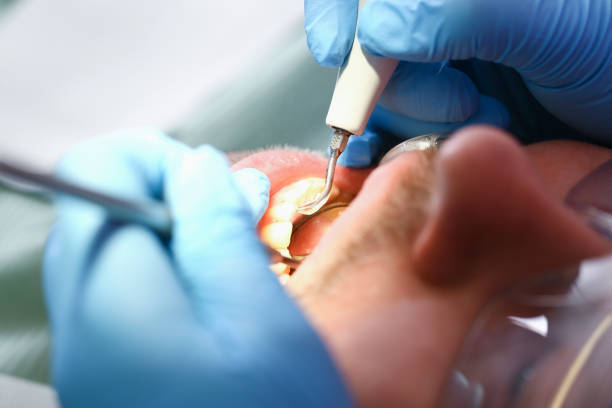 Best Dental Abscess Treatment in Nome, AK